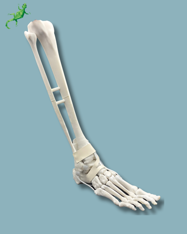 Pied et tibia avec arthrose de la cheville COFAS 1 avec ligaments/tendons/rétinaculum - Ref 02-14-02 – Image 2