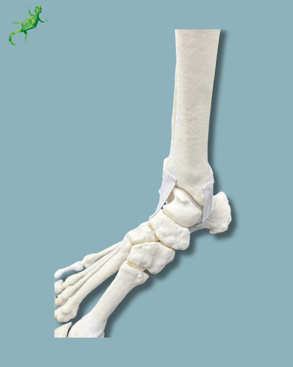 Pied et tibia avec une arthrose de la cheville varus COFAS 2, Addi-CORT+ - Ref 02-10-02 – Image 7