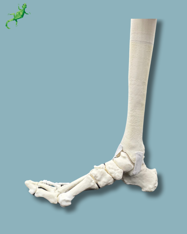 Pied et tibia avec une arthrose de la cheville varus COFAS 2, Addi-CORT+ - Ref 02-10-02 – Image 8