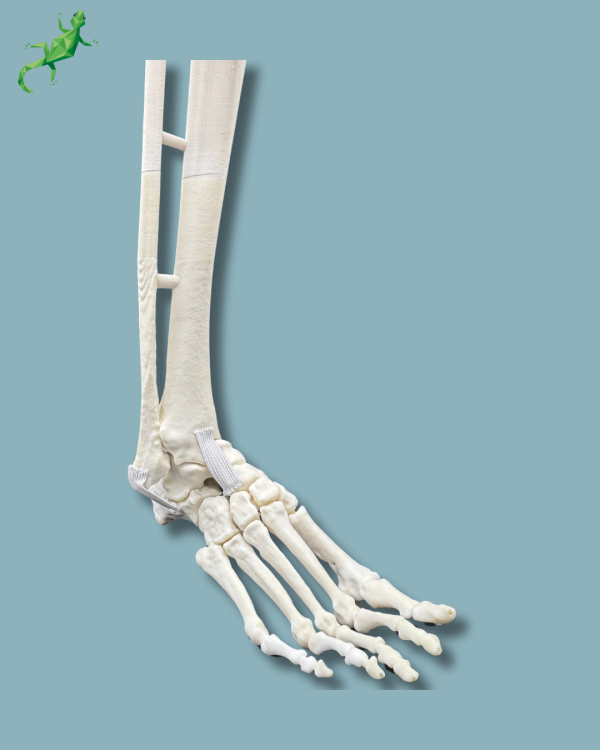 Pied et tibia avec une arthrose de la cheville varus COFAS 2, Addi-CORT+ - Ref 02-10-02 – Image 10