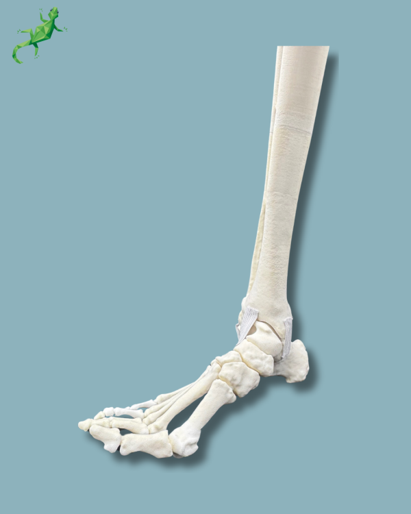 Pied et tibia avec une arthrose de la cheville varus COFAS 2, Addi-CORT+ - Ref 02-10-02 – Image 5