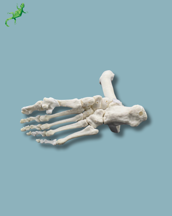 Pied et tibia avec une arthrose de la cheville varus COFAS 2, Addi-CORT+ - Ref 02-10-02 – Image 6
