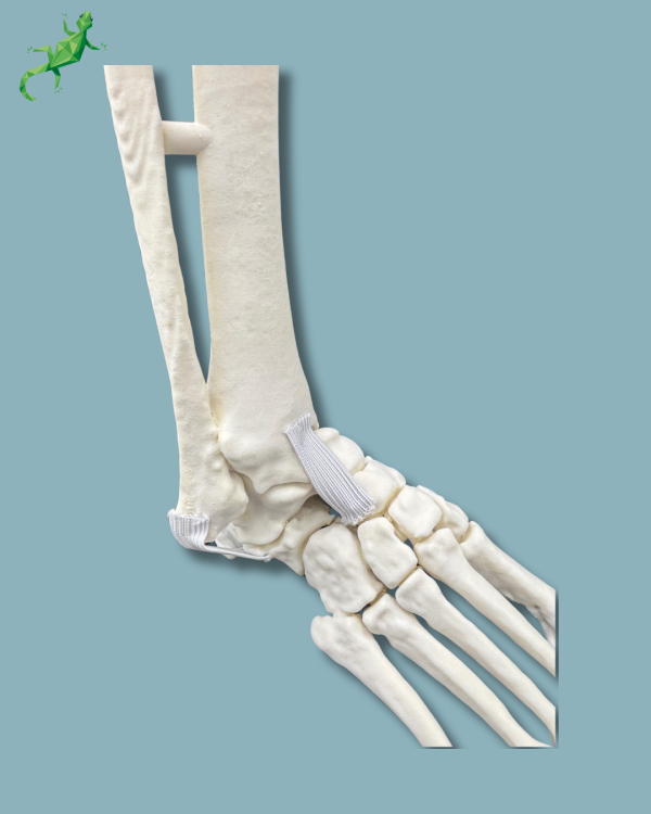 Pied et tibia avec une arthrose de la cheville varus COFAS 2, Addi-CORT+ - Ref 02-10-02 – Image 9