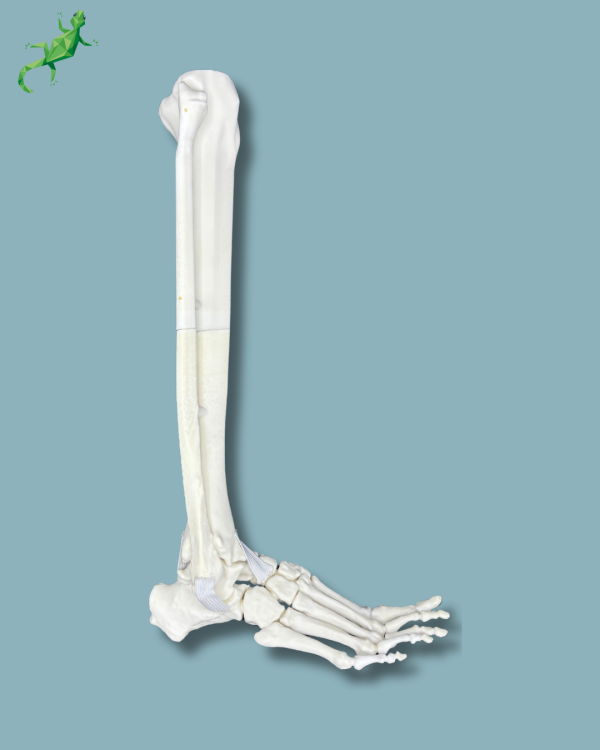 Pied et tibia avec une arthrose de la cheville varus COFAS 2, Addi-CORT+ - Ref 02-10-02 – Image 4