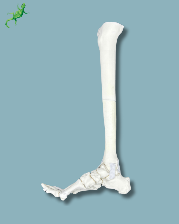 Pied et tibia avec une arthrose de la cheville varus COFAS 2, Addi-CORT+ - Ref 02-10-02 – Image 3