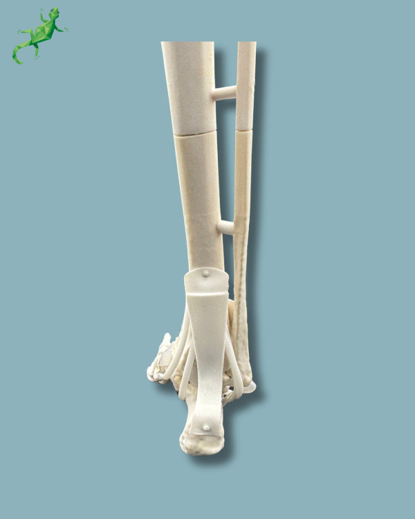 Foot and tibia with a COFAS 2 ankle arthritis with ligaments/tendons/retinaculum - Ref 02-13-02 - Image 7