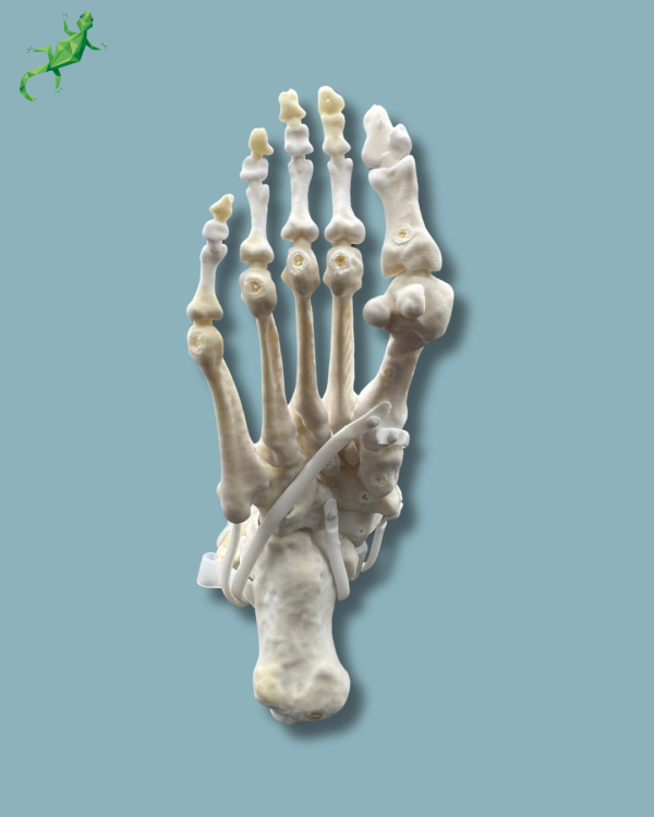 Foot and tibia with a COFAS 2 ankle arthritis with ligaments/tendons/retinaculum - Ref 02-13-02 - Image 2