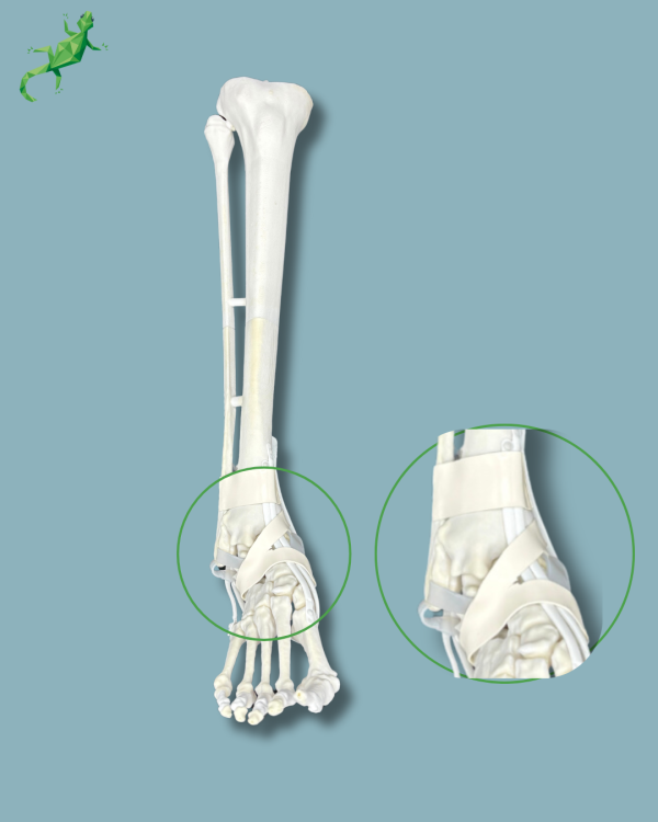 Foot and tibia with a COFAS 2 ankle arthritis with ligaments/tendons/retinaculum - Ref 02-13-02