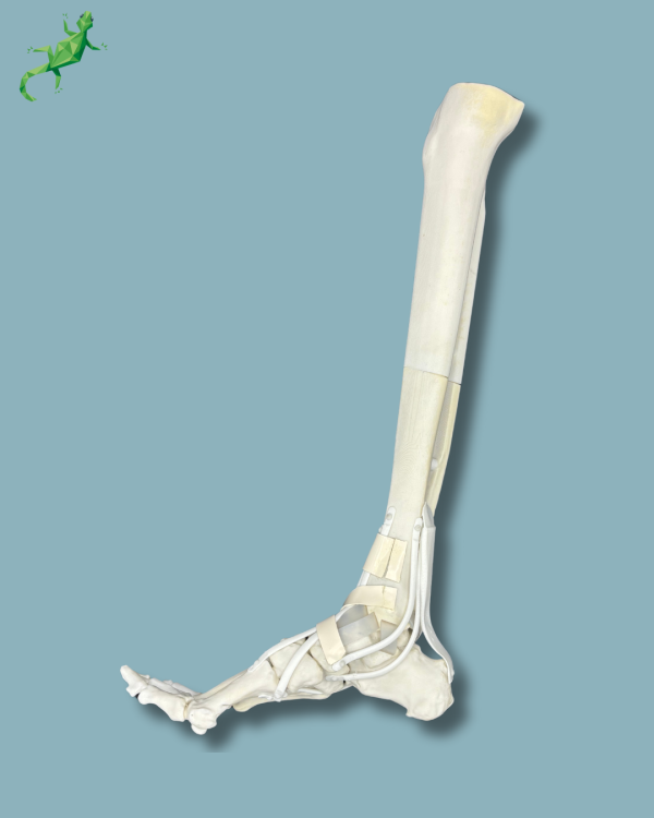 Foot and tibia with a COFAS 2 ankle arthritis with ligaments/tendons/retinaculum - Ref 02-13-02 - Image 5