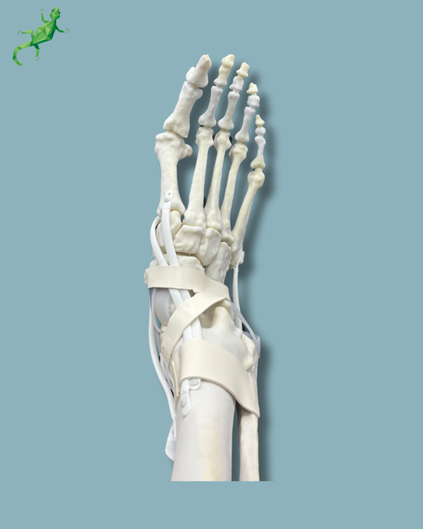 Foot and tibia with a COFAS 2 ankle arthritis with ligaments/tendons/retinaculum - Ref 02-13-02 - Image 4