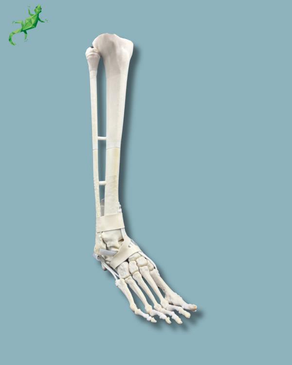 Pied et tibia avec un COFAS 2 Varus et cheville arthrosique / Droit / Addi CORT+ Addi-SOFT - Ref 02-13-02 – Image 7