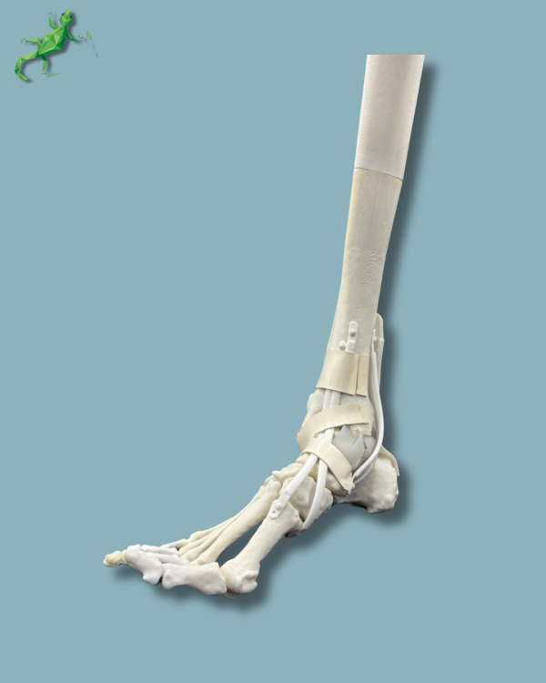 Foot and tibia with a COFAS 2 ankle arthritis with ligaments/tendons/retinaculum - Ref 02-13-02 - Image 3