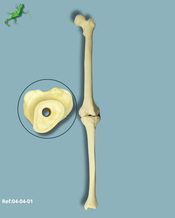 Genou / Moyen / Gauche / Addi-CORT avec canal intramédullaire - Ref 04-04-01