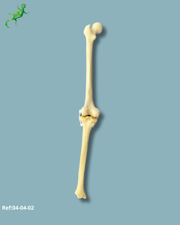 Knee / Medium / Left / Addi-CORT with intramedullar canal - Ref 04-04-02 - Image 2