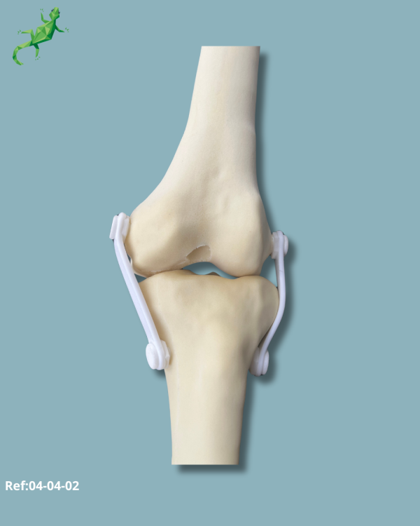Knee / Medium / Left / Addi-CORT with intramedullar canal - Ref 04-04-02 - Image 8