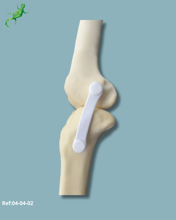 Knee / Medium / Left / Addi-CORT with intramedullar canal - Ref 04-04-02 - Image 7