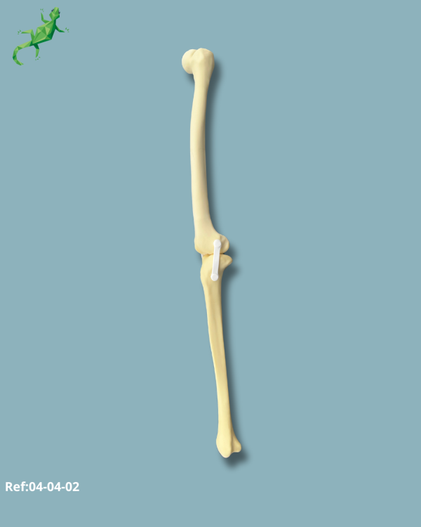Knee / Medium / Left / Addi-CORT with intramedullar canal - Ref 04-04-02 - Image 4