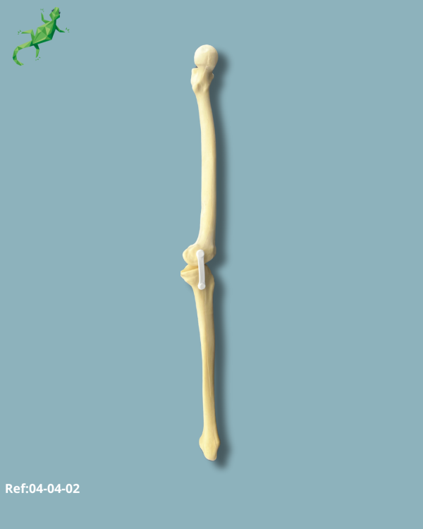 Knee / Medium / Left / Addi-CORT with intramedullar canal - Ref 04-04-02 - Image 3