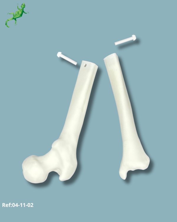 Knee reusable part / Solid plastic / Addi-ARC - Ref 04-11-02