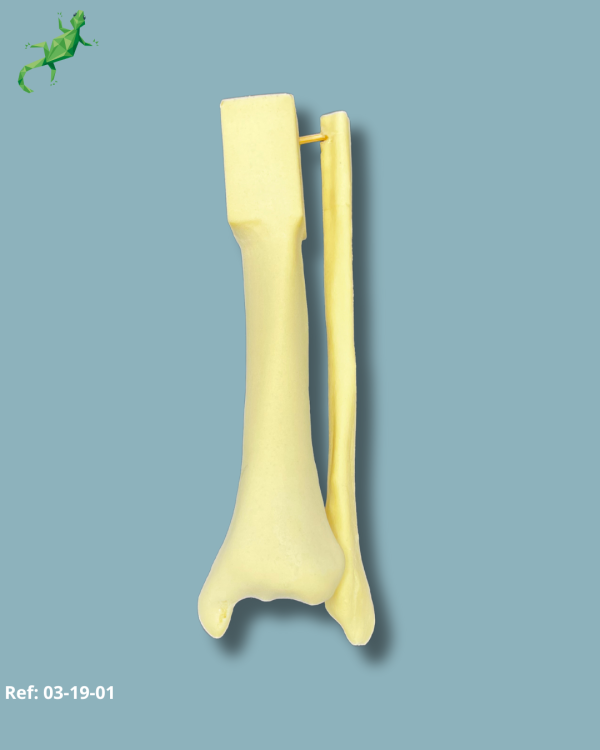 Mi-Tibia et Fibula / Moyen / Gauche / Addi-CAN - Ref 03-19-01