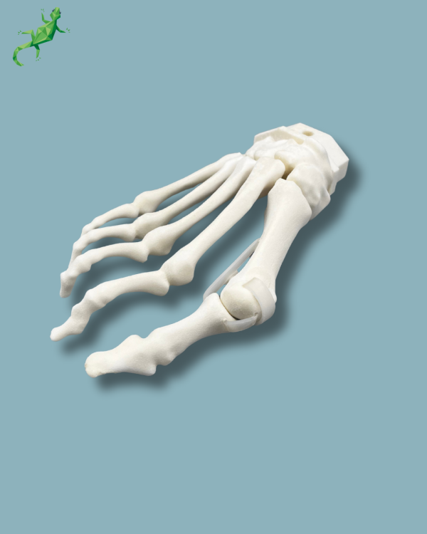 Avant-Pied droit avec malformation - Ref 01-15-02