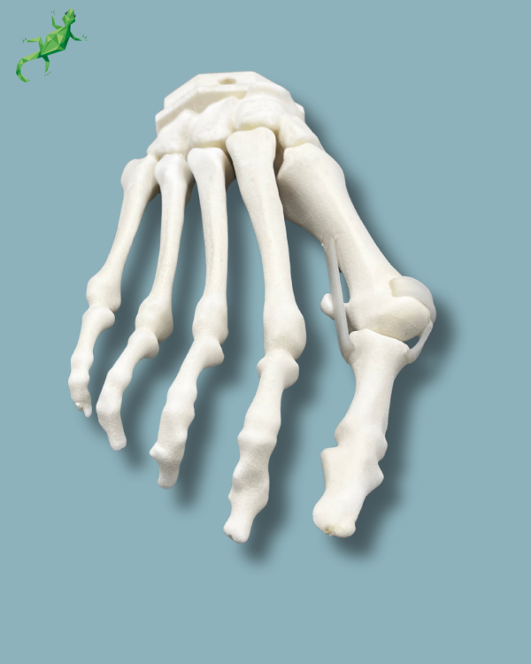 Avant-Pied droit avec malformation - Ref 01-15-02 – Image 5