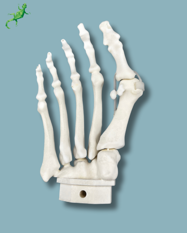 Avant-Pied droit avec malformation - Ref 01-15-02 – Image 4