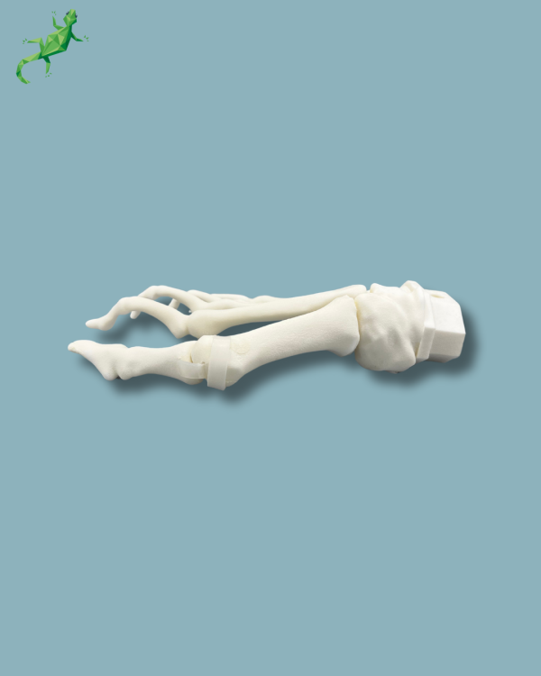 Avant-Pied droit avec malformation - Ref 01-15-02 – Image 11