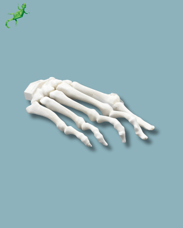 Avant-Pied droit avec malformation - Ref 01-15-02 – Image 10
