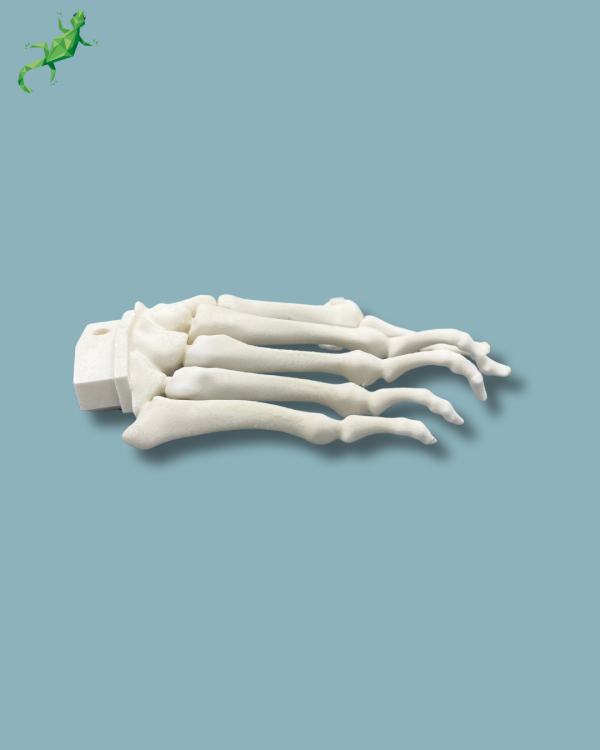 Avant-Pied droit avec malformation - Ref 01-15-02 – Image 9