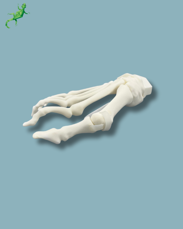Avant-Pied droit avec malformation - Ref 01-15-02 – Image 12
