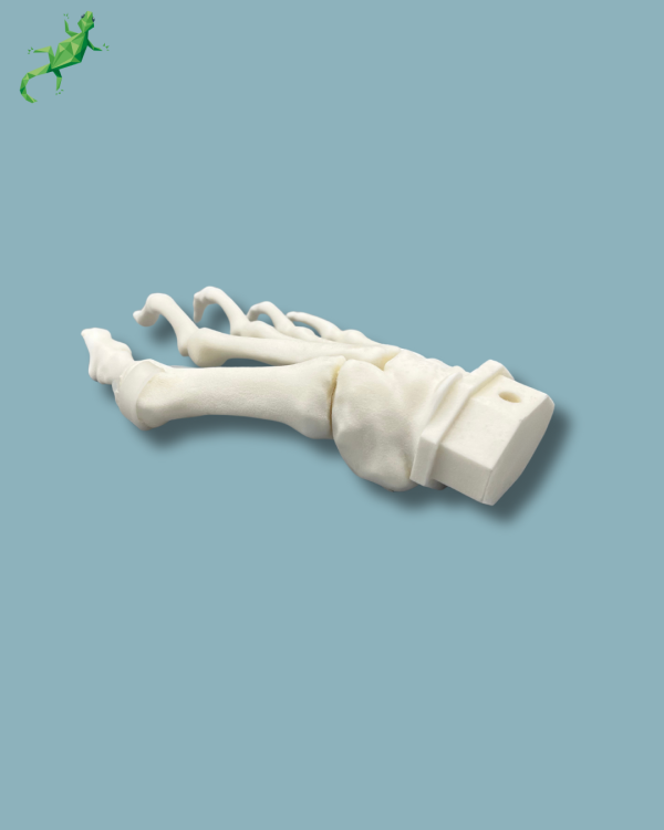Avant-Pied droit avec malformation - Ref 01-15-02 – Image 6