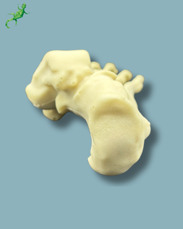 Flatfoot with forefoot deformities / Right / Addi CAN - Ref 01-07-02 - Image 3