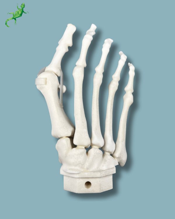 Avant-Pied droit avec malformation - Ref 01-15-02 – Image 3