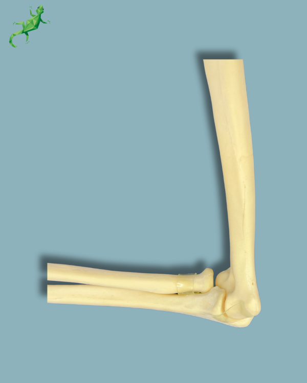 Elbow / Addi-CAN - Ref 14-02-02 - Image 7