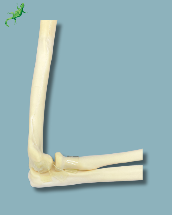 Elbow / Addi-CAN - Ref 14-02-02 - Image 8