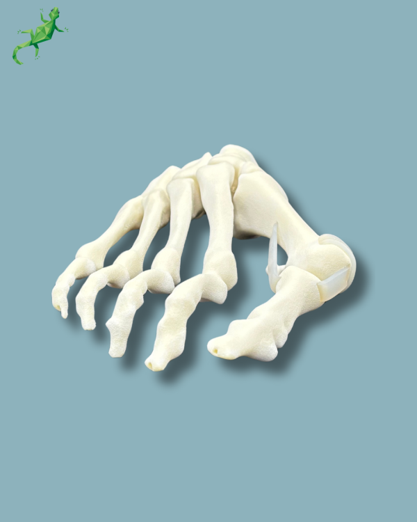Replaceable forefoot right with deformity - Ref 01-15-02 - Image 6