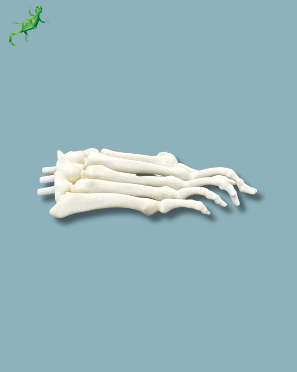 Replaceable forefoot right with deformity - Ref 01-15-02 - Image 5