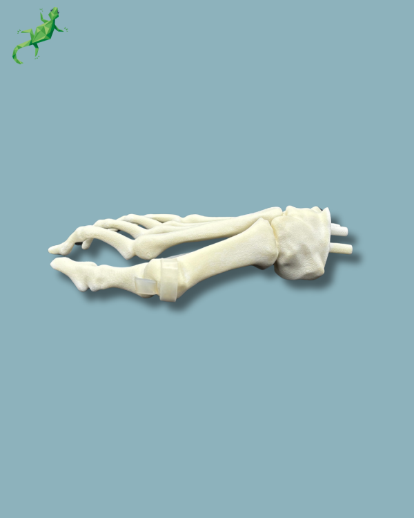 Replaceable forefoot right with deformity - Ref 01-15-02 - Image 4