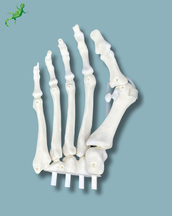 Replaceable forefoot right with deformity - Ref 01-15-02 - Image 3