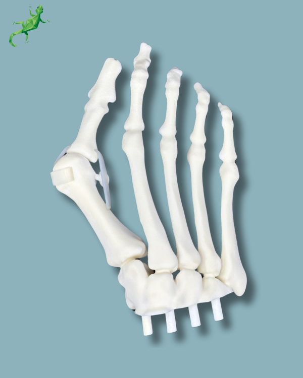 Replaceable forefoot right with deformity - Ref 01-15-02 - Image 2