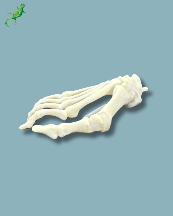 Replaceable forefoot right with deformity - Ref 01-15-02