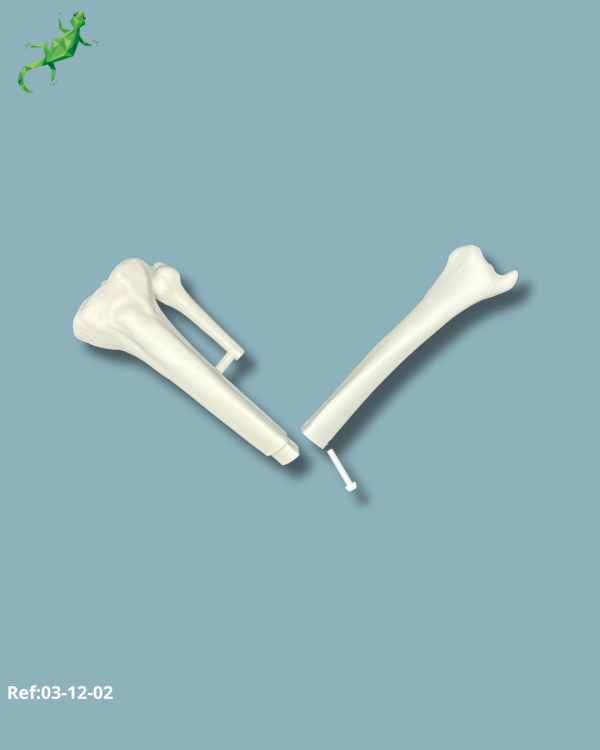 Tibia Pack / Medium / Left / Add-CORT+ Addi-ARC - Ref 03-12-02