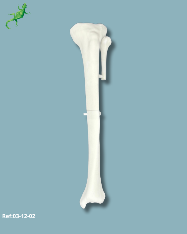 Tibia Pack / Medium / Left / Add-CORT+ Addi-ARC - Ref 03-12-02 - Image 3