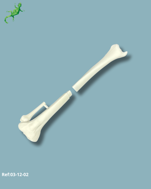 Tibia Pack / Medium / Left / Add-CORT+ Addi-ARC - Ref 03-12-02 - Image 2