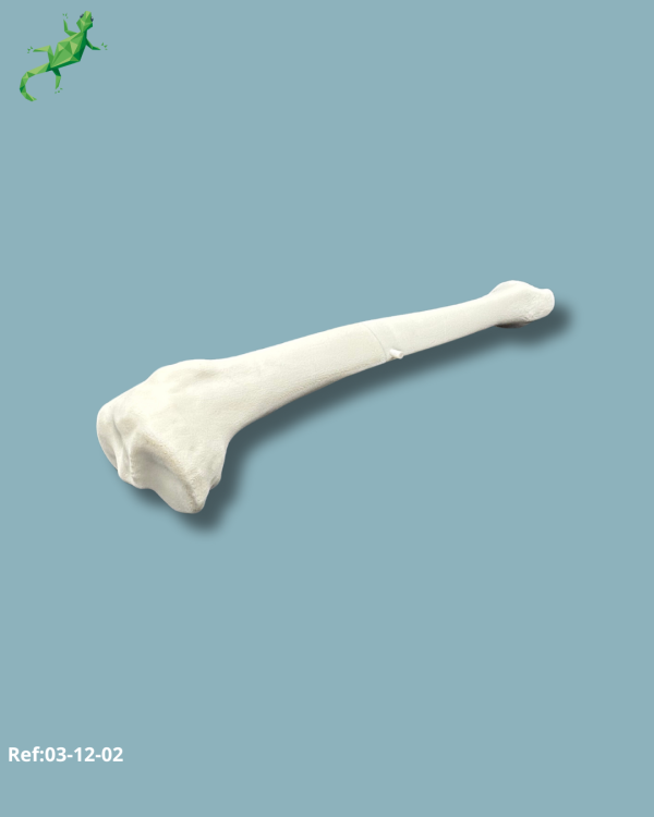 Tibia Pack / Medium / Left / Add-CORT+ Addi-ARC - Ref 03-12-02 - Image 6