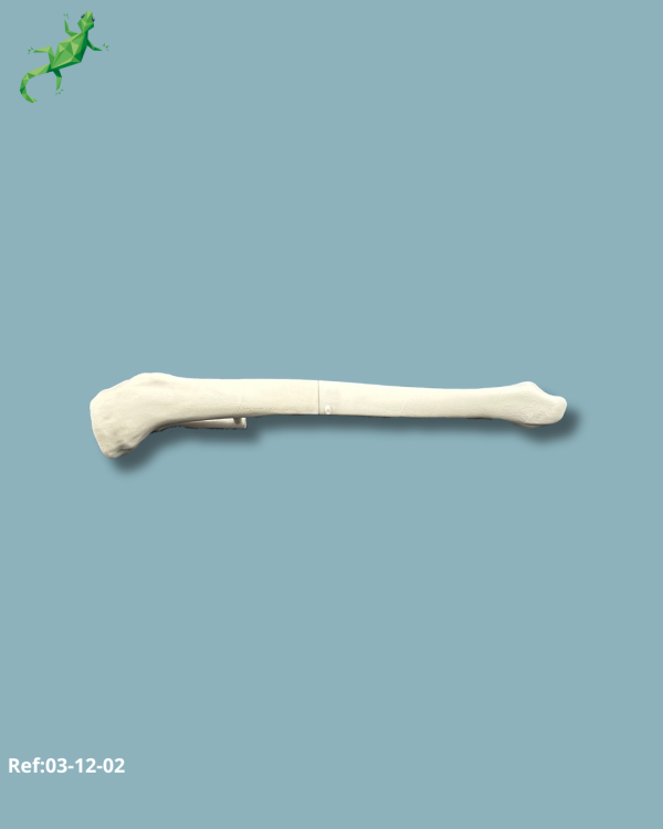 Tibia Pack / Medium / Left / Add-CORT+ Addi-ARC - Ref 03-12-02 - Image 7