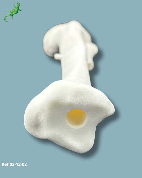 Tibia Pack / Medium / Left / Add-CORT+ Addi-ARC - Ref 03-12-02 - Image 10