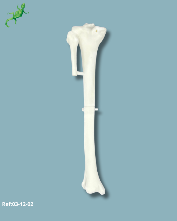 Pack Tibia / Moyen / Gauche / Addi-CORT+ Addi-ARC - Ref 03-12-02 – Image 4