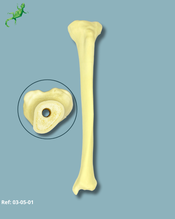 Tibia / Medium / Left / Addi-CORT with intermedullar canal - Ref 03-05-01
